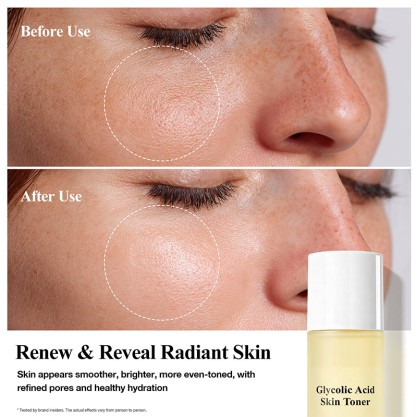 Glycolic Acid Exfoliating Toner Pore Minimizing Hydrating Brightening